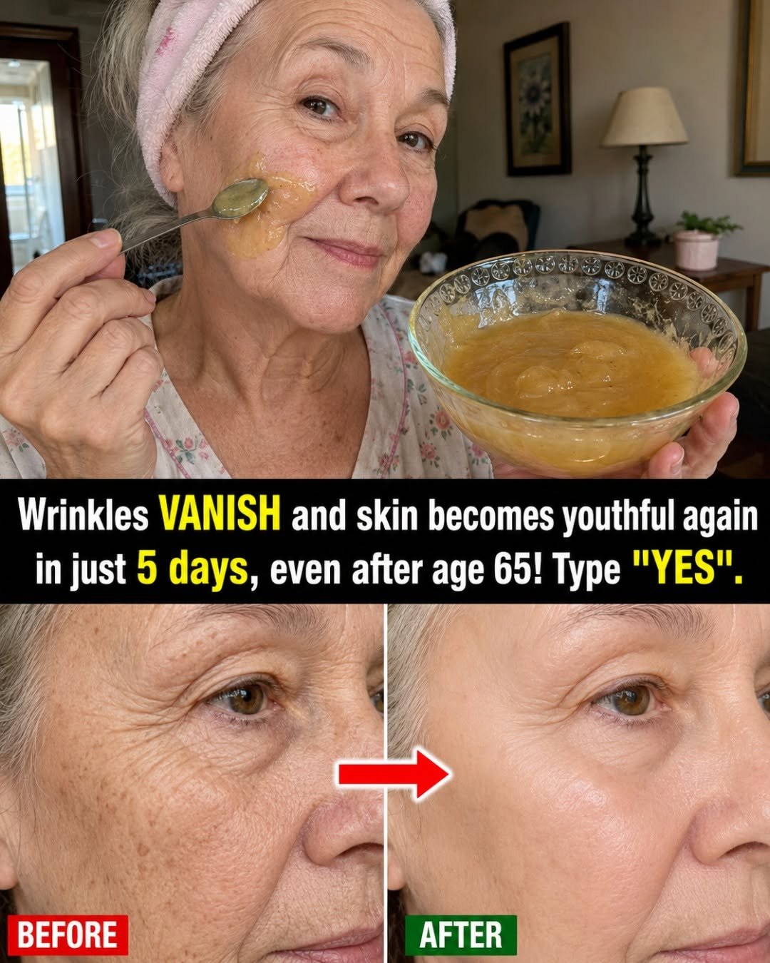 After age 65, changes in the skin become more noticeable. Fine lines, dryness, uneven texture