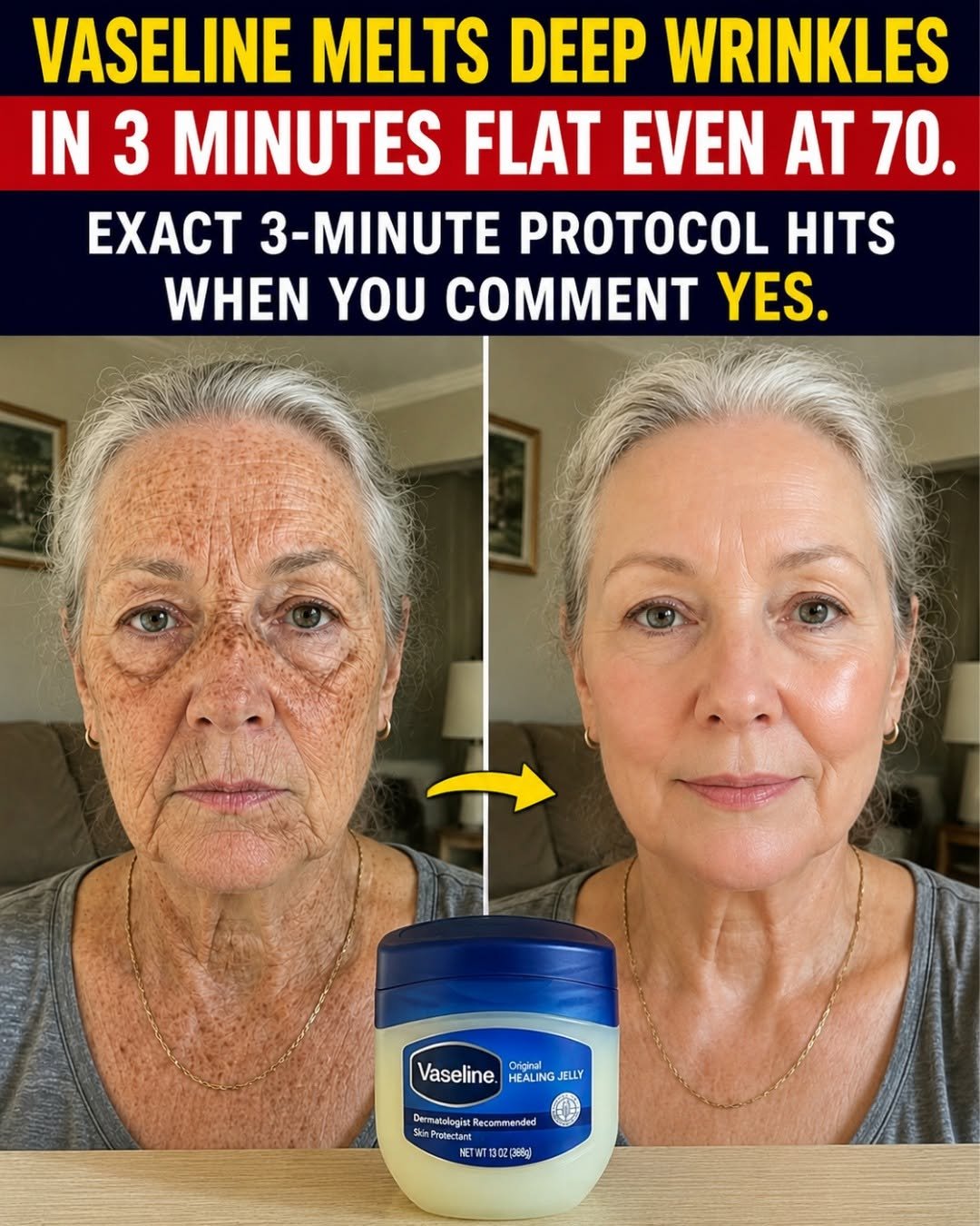 Vaseline is one of the simplest skincare products in the world,