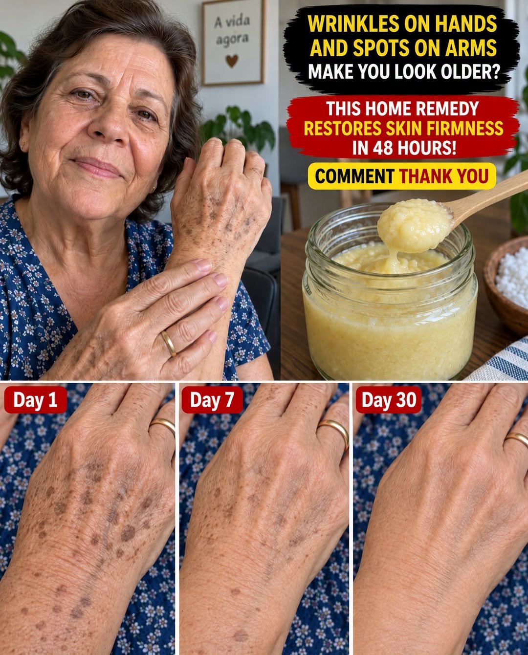How to Improve Wrinkled Hands and Dark Spots Naturally: A Simple Homemade Skin Care Remedy